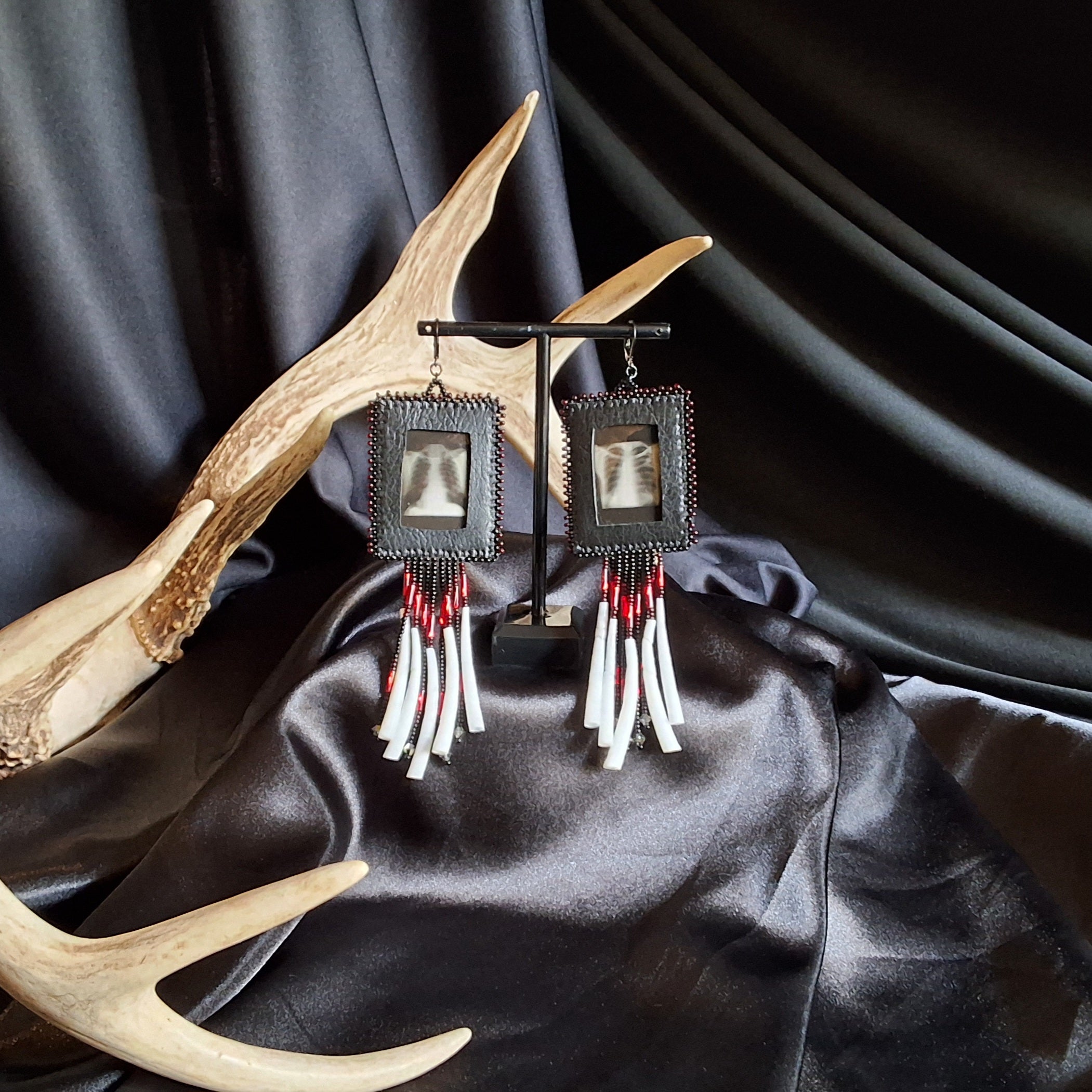 Chest X-ray Earrings